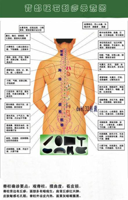 后背刮痧图片,揭秘古老疗法的现代魅力